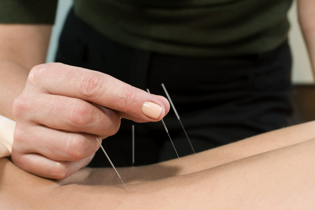 about TCM – anthos acupuncture & herbal clinic