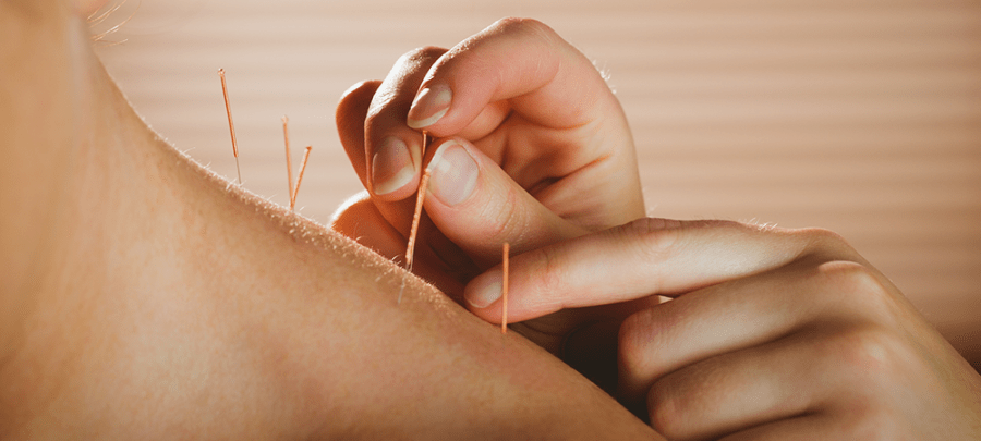 Boost Your Athletic Performance with Acupuncture
